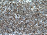 CCR6 Antibody in Immunohistochemistry (Paraffin) (IHC (P))