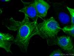 Cytokeratin 16 Antibody in Immunocytochemistry (ICC/IF)