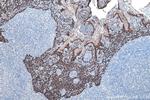 Cytokeratin 16 Antibody in Immunohistochemistry (Paraffin) (IHC (P))