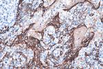 Cytokeratin 16 Antibody in Immunohistochemistry (Paraffin) (IHC (P))