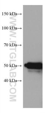 Cytokeratin 16 Antibody in Western Blot (WB)