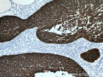 Cytokeratin 16 Antibody in Immunohistochemistry (Paraffin) (IHC (P))