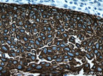 Cytokeratin 16 Antibody in Immunohistochemistry (Paraffin) (IHC (P))