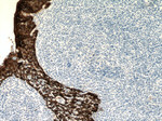 Cytokeratin 16 Antibody in Immunohistochemistry (Paraffin) (IHC (P))