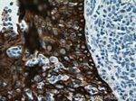 Cytokeratin 16 Antibody in Immunohistochemistry (Paraffin) (IHC (P))