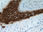 Cytokeratin 16 Antibody in Immunohistochemistry (Paraffin) (IHC (P))