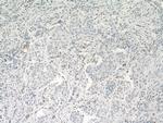 CDH5 Antibody in Immunohistochemistry (Paraffin) (IHC (P))