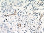 CDH5 Antibody in Immunohistochemistry (Paraffin) (IHC (P))