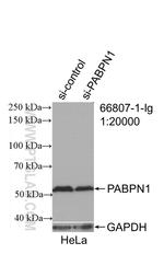 PABPN1 Antibody in Western Blot (WB)