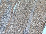 GCLM Antibody in Immunohistochemistry (Paraffin) (IHC (P))