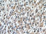 GCLM Antibody in Immunohistochemistry (Paraffin) (IHC (P))