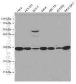 GCLM Antibody in Western Blot (WB)