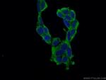 PABPC1/PABP Antibody in Immunocytochemistry (ICC/IF)