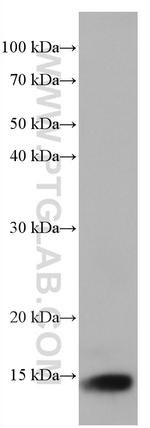 Cystatin B Antibody in Western Blot (WB)