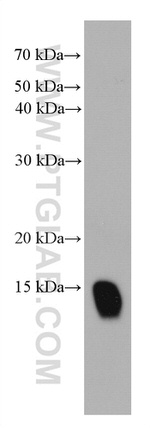 Cystatin B Antibody in Western Blot (WB)