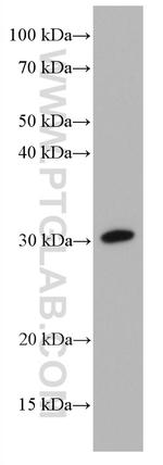 DIO2 Antibody in Western Blot (WB)