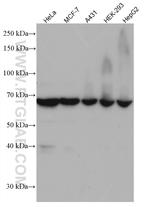 RARS Antibody in Western Blot (WB)