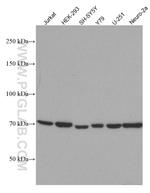 CHAT Antibody in Western Blot (WB)