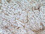 Collagen Type VI Antibody in Immunohistochemistry (Paraffin) (IHC (P))