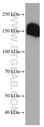 Collagen Type VI Antibody in Western Blot (WB)