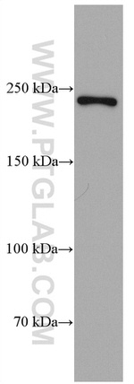 MYH14 Antibody in Western Blot (WB)