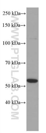 PPARA Antibody in Western Blot (WB)