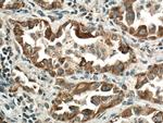 VEGFA Antibody in Immunohistochemistry (Paraffin) (IHC (P))