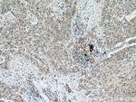 VEGFA Antibody in Immunohistochemistry (Paraffin) (IHC (P))