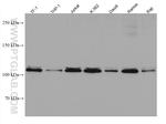 IL-12RB1 Antibody in Western Blot (WB)