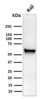 Spastin Antibody in Western Blot (WB)