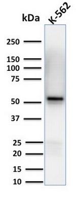 Spastin Antibody in Western Blot (WB)