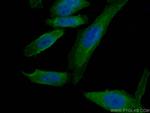 APOE Antibody in Immunocytochemistry (ICC/IF)