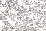 AGER Antibody in Immunohistochemistry (Paraffin) (IHC (P))