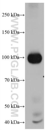 AOC3 Antibody in Western Blot (WB)