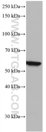 IRF5 Antibody in Western Blot (WB)