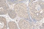 MBNL1 Antibody in Immunohistochemistry (Paraffin) (IHC (P))