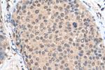 MBNL1 Antibody in Immunohistochemistry (Paraffin) (IHC (P))