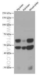 CAMK2 Antibody in Western Blot (WB)