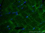 GLUT4 Antibody in Immunohistochemistry (PFA fixed) (IHC (PFA))