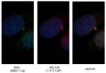 SMO Antibody in Immunocytochemistry (ICC/IF)