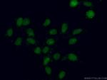 XRN2 Antibody in Immunocytochemistry (ICC/IF)