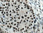 XRN2 Antibody in Immunohistochemistry (Paraffin) (IHC (P))