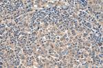 ACVRL1 Antibody in Immunohistochemistry (Paraffin) (IHC (P))