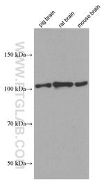 CYLD Antibody in Western Blot (WB)