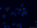 PCK1 Antibody in Immunocytochemistry (ICC/IF)