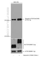 RICTOR Antibody in Western Blot (WB)