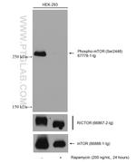 RICTOR Antibody in Western Blot (WB)