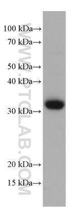CD8 Antibody in Western Blot (WB)