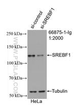 SREBF1 Antibody in Western Blot (WB)