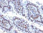 PU.1 (SPI-1) Antibody in Immunohistochemistry (Paraffin) (IHC (P))